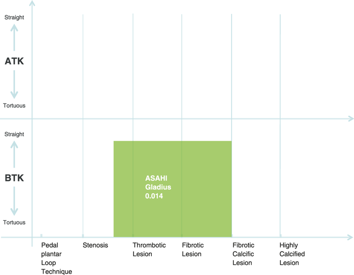 Wire_Chart_Gladius_0014