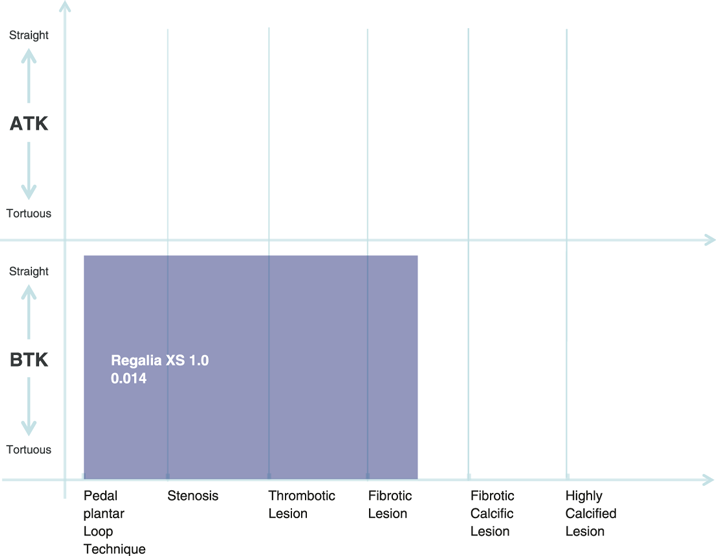 Wire_Chart_RegaliaXS1